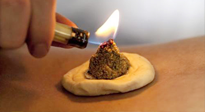 【艾灸知識(shí)】十大常見艾灸不良反應(yīng)，及處理方法！建議收藏！